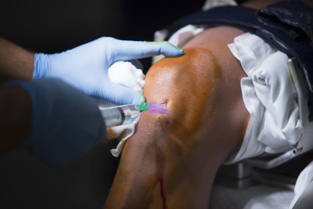 Doctor injecting medication into patient's knee at Belfast Private GP in Belfast